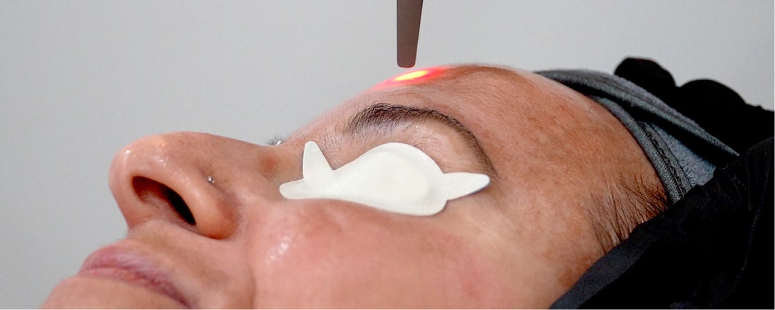 Laser treatment: behind the scenes